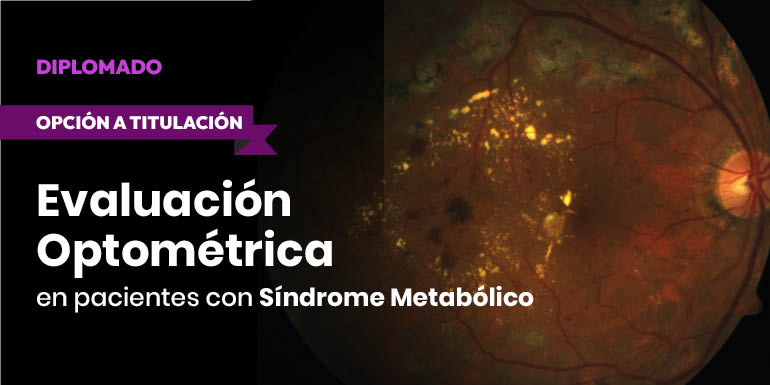 Evaluación Optométrica en Pacientes con Síndrome Metabólico