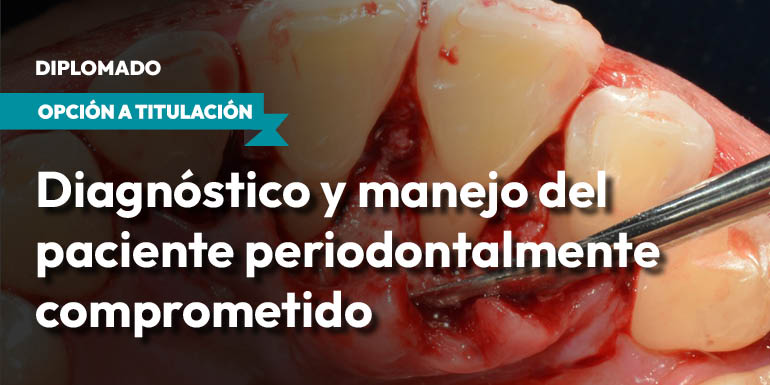 Diagnóstico y Manejo del Paciente Periodontalmente Comprometido