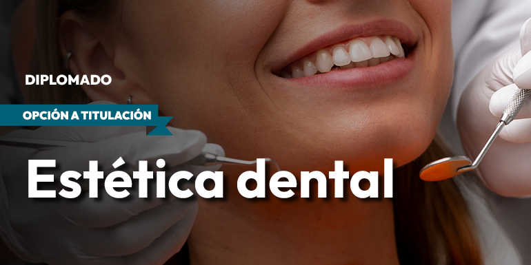 Estética Dental